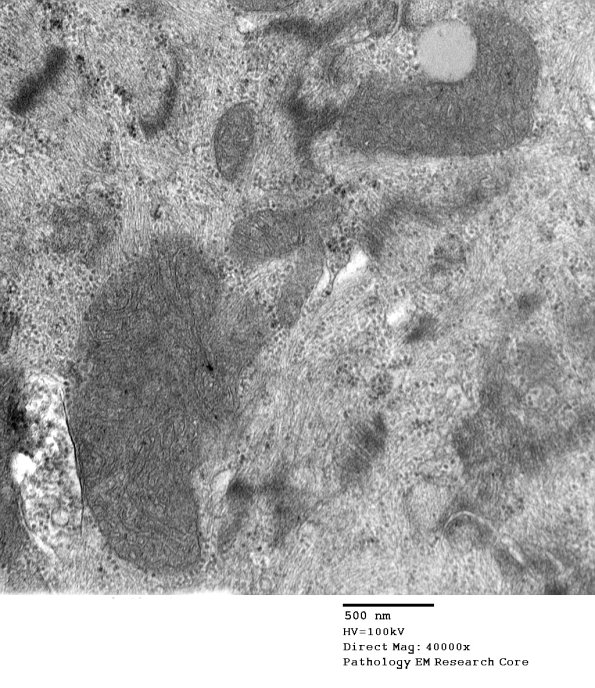 14A7B Case 14 025 - Copy