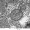 17A1B  Case 17_007 - Copy