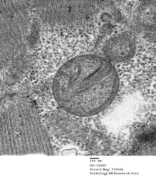 17A1B  Case 17_007 - Copy