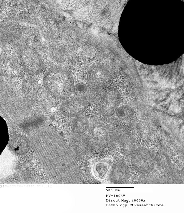 17A1C Case 17_017 - Copy