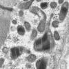 18B1C (Case 18) Muscle_009 - Copy