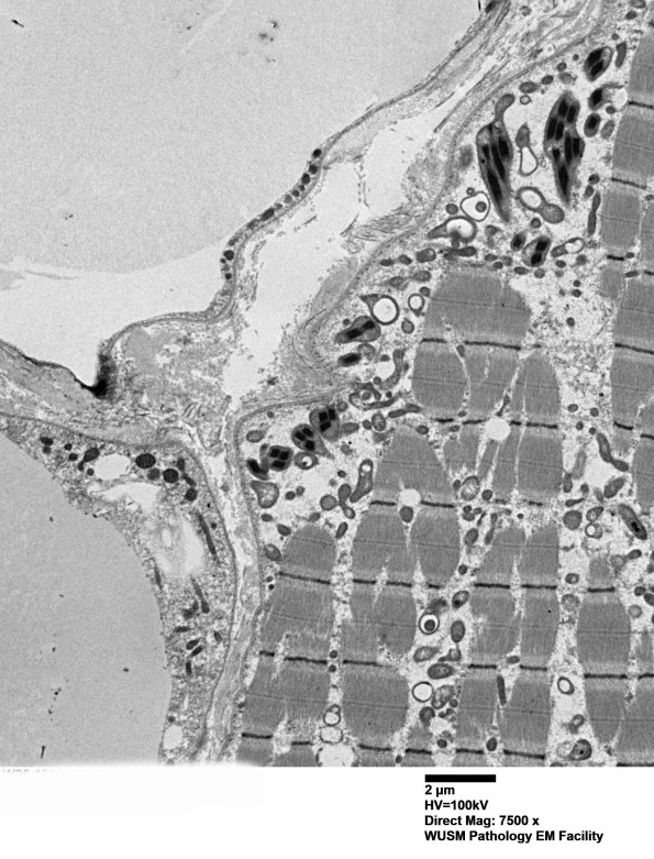 18B1F (Case 18) Muscle_024 - Copy