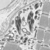 18B1G (Case 18) Muscle_026 - Copy