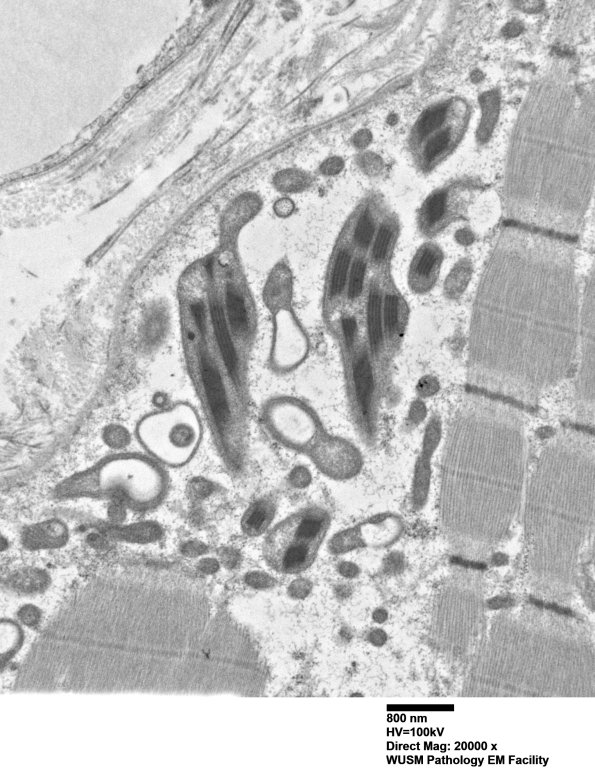 18B1G (Case 18) Muscle_026 - Copy