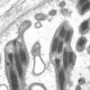 18B1H (Case 18) Muscle_027 - Copy
