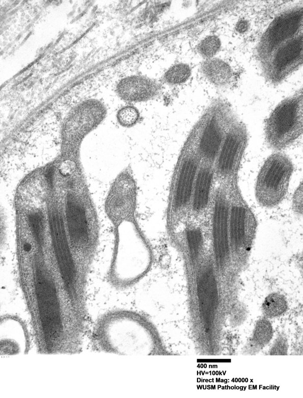 18B1H (Case 18) Muscle_027 - Copy