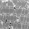 18B2A (Case 18) Muscle_020 - Copy