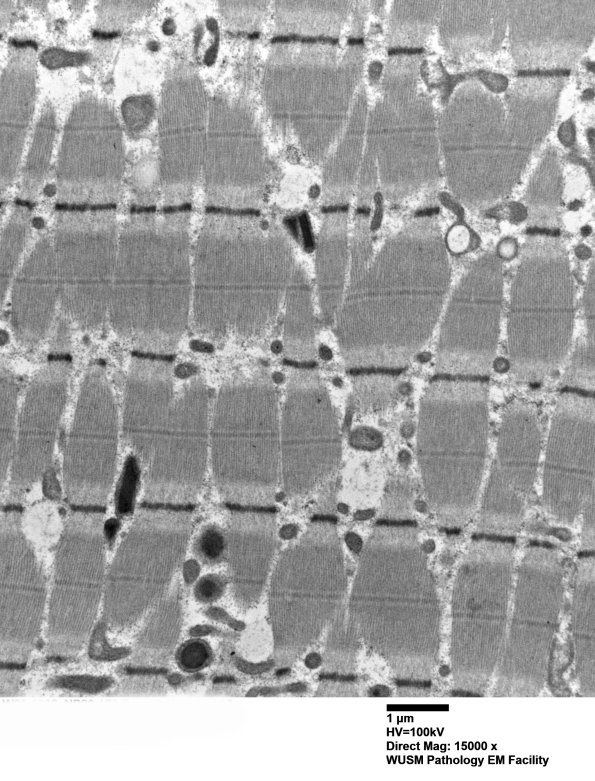 18B2A (Case 18) Muscle_020 - Copy