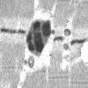 18B2C (Case 18) Muscle_019 - Copy