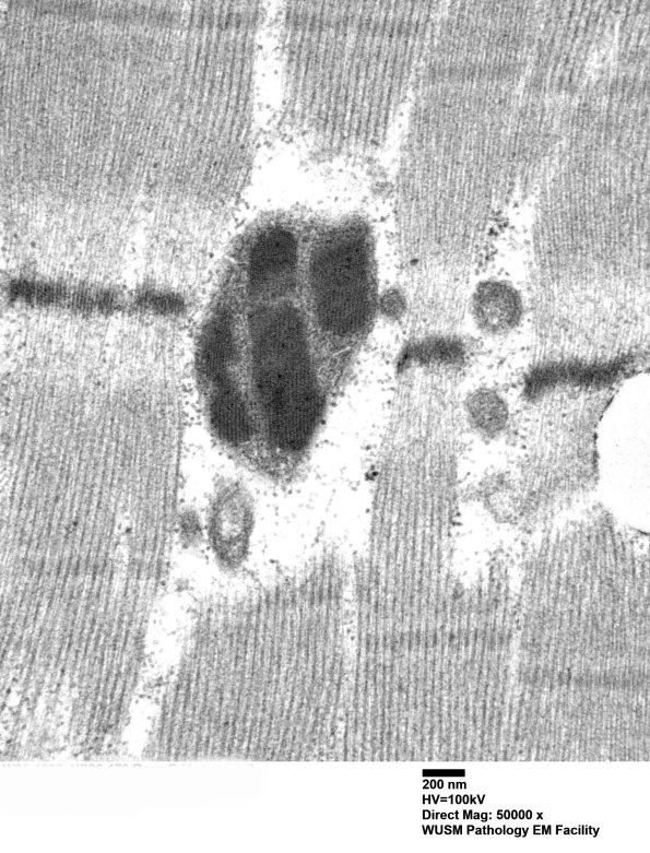 18B2C (Case 18) Muscle_019 - Copy
