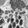 18B3 (Case 18) Muscle_010 - Copy