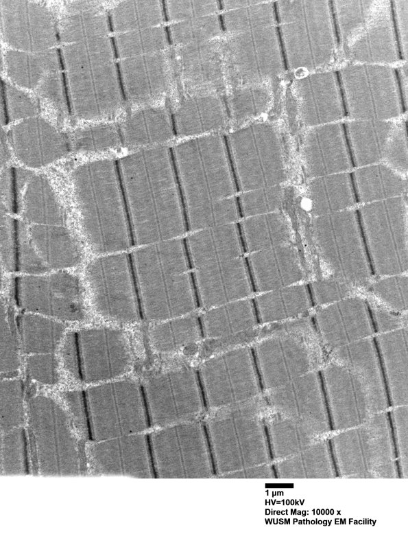 18D3A (Case 18) deltoid muscle_026 - Copy - Copy