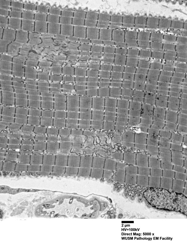 19A1A (Case 19) Muscle_019 - Copy