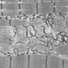 19A1B (Case 19) Muscle_020 - Copy