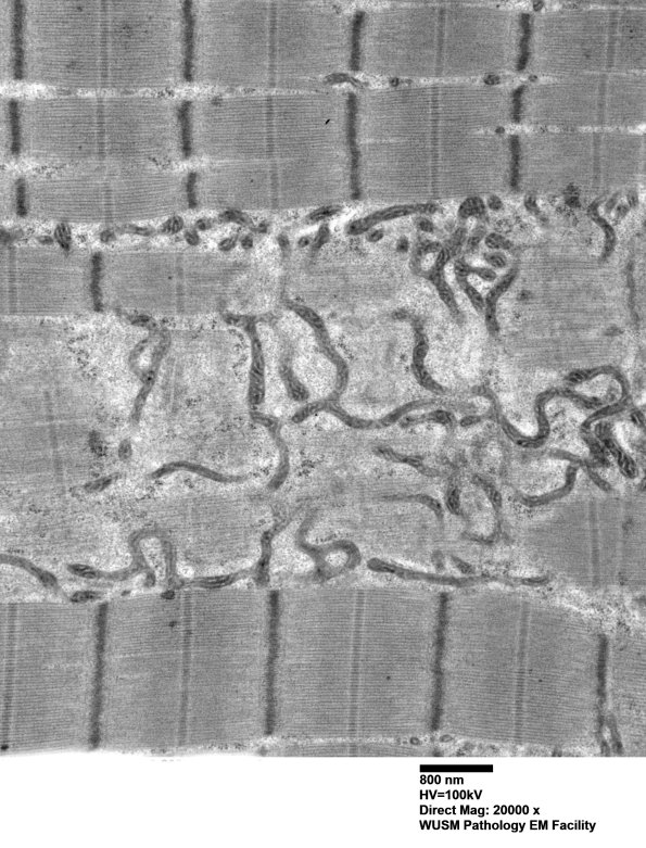 19A1B (Case 19) Muscle_020 - Copy