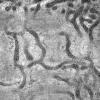19A1C (Case 19) Muscle_023 - Copy