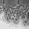 19A2A (Case 19) Muscle_024 - Copy