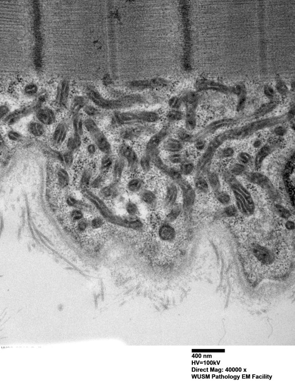 19A2A (Case 19) Muscle_024 - Copy