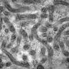 19A2B (Case 19) Muscle_025 - Copy