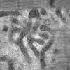 19A2C (Case 19) Muscle_026 - Copy