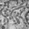 19A2D (Case 19) Muscle_029 - Copy