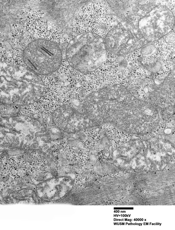 20A5 (Case 20) muscle_074 - Copy