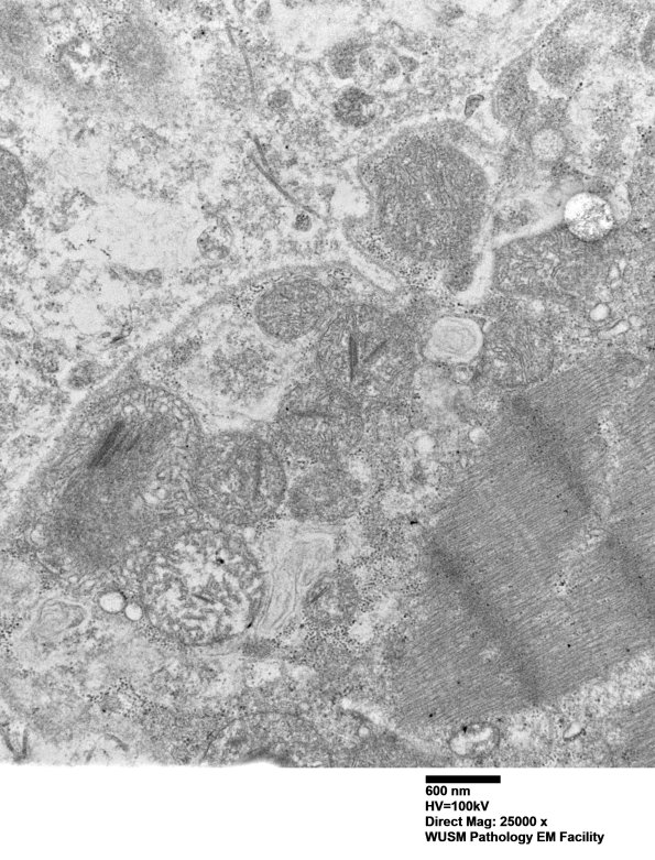 20A6 (Case 20) muscle_063 - Copy