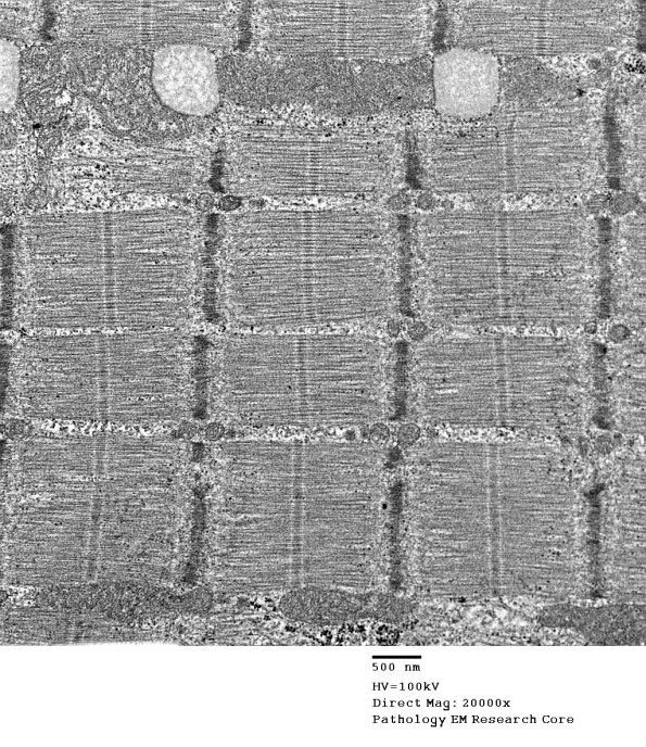 22A1B (Case 22)_011 - CopyA