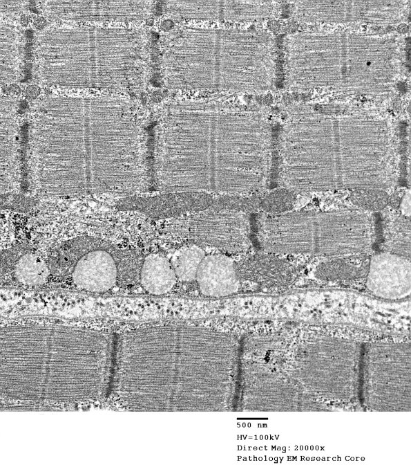 22A1C (Case 22)_010 - CopyA