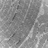 23A1 (Case 23) Muscle_001 - Copy