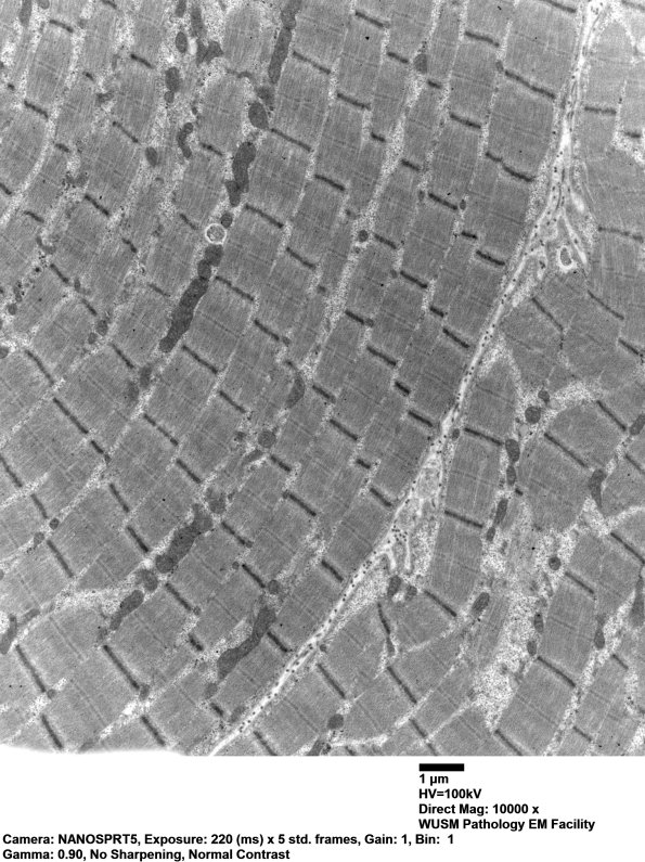 23A1 (Case 23) Muscle_001 - Copy