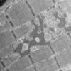 23A3 (Case 23) Muscle_010 - Copy