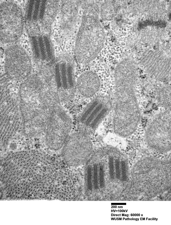24A1B (Case 24) muscle_025 - Copy