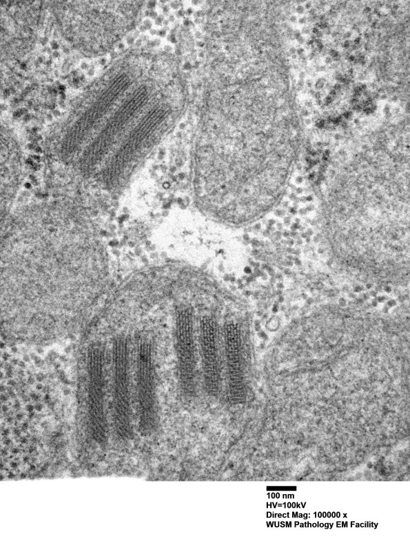 24A1C (Case 24) muscle_026 - Copy