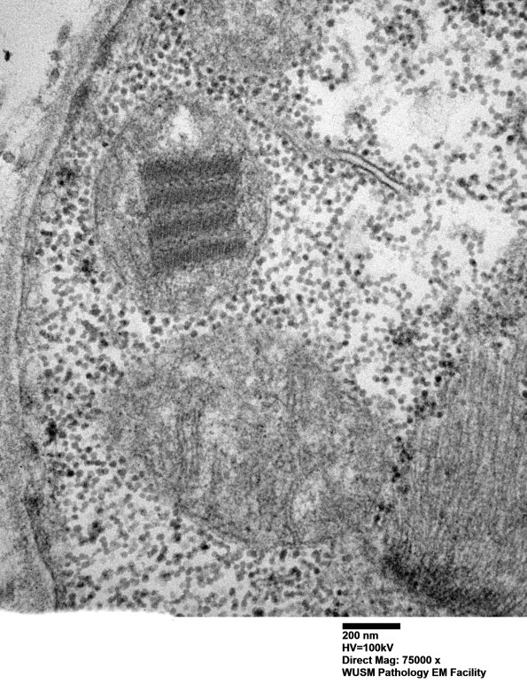 24A2 (Case 24) muscle_030 - Copy