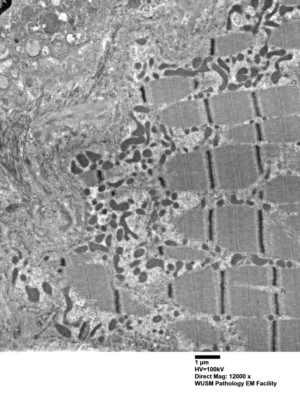 26A2 (Case 26) muscle_018 - Copy