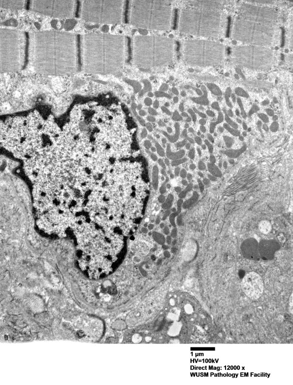 26A3  (Case 26) muscle_021 - Copy