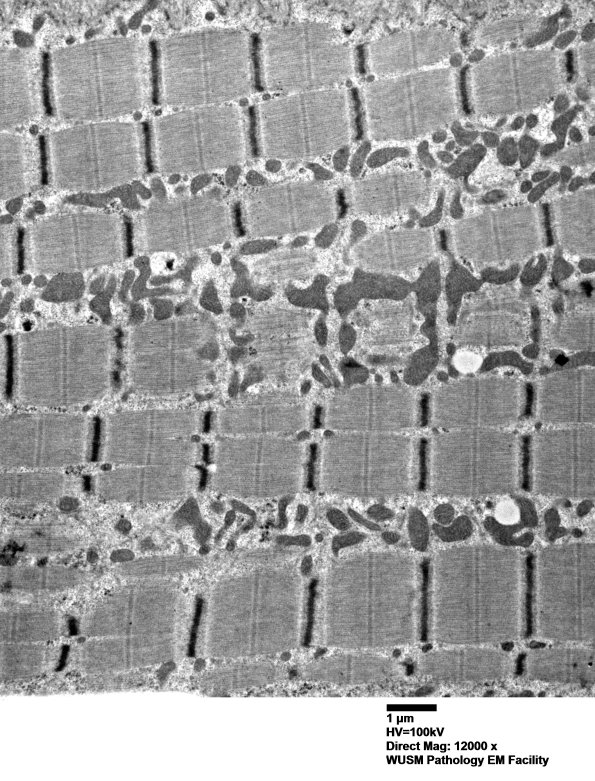 26A4A (Case 26) muscle_020 - Copy