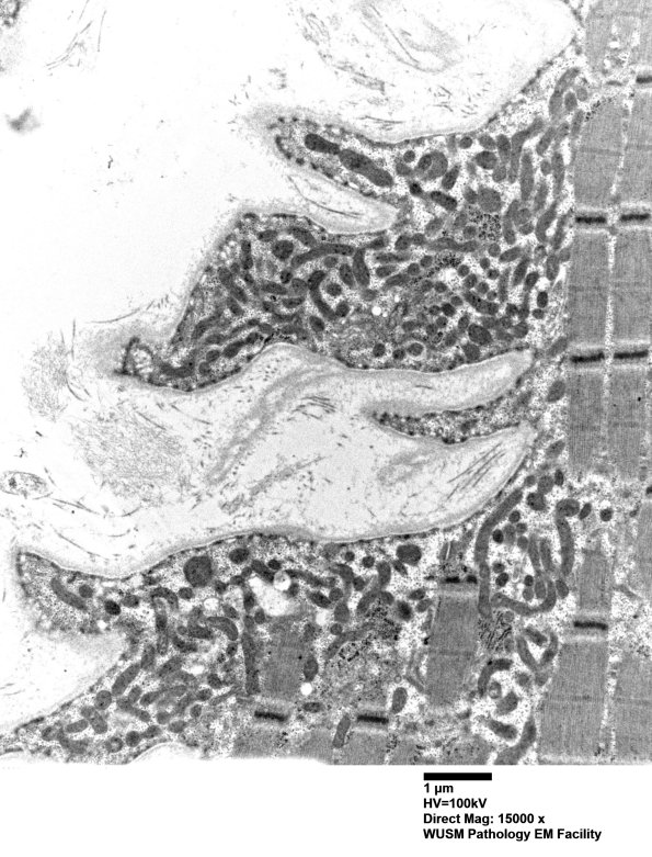 28A1B (Case 28) muscle_034 - Copy