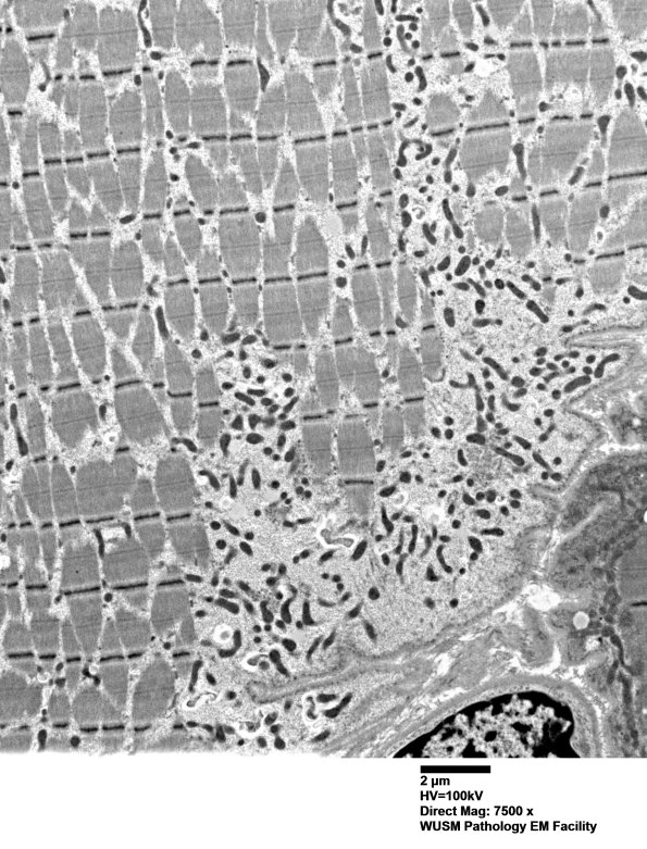28A2A (Case 28) muscle_021 - Copy