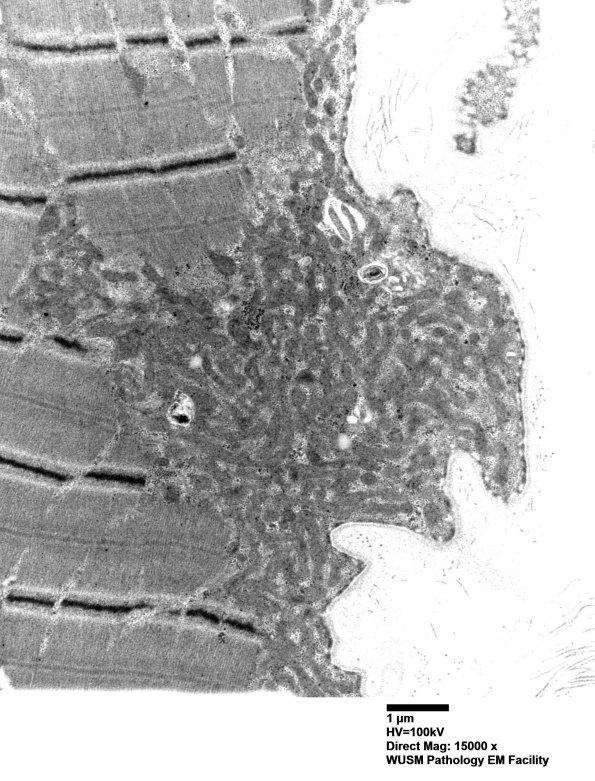 28A3A (Case 28) muscle_040 - Copy