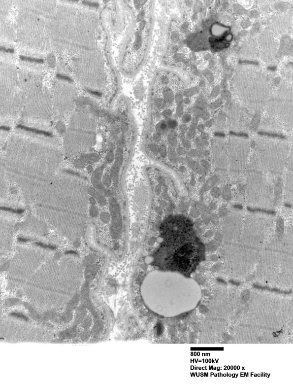 28A5 (Case 28) muscle_020 - Copy