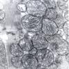 2A3 Mitochondrial Myopathy (Case 2) EM 2 - Copy