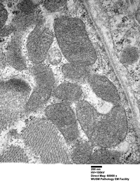 30A1D (Case 30) muscle_019 - Copy