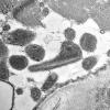 31A1C (Case 31) Muscle_004 - CopyA