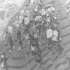 36A1 (Case 36) Cervical Paraspinal_012 - Copy