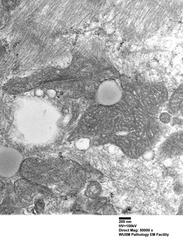 36A3 (Case 36) Cervical Paraspinal_018 - Copy