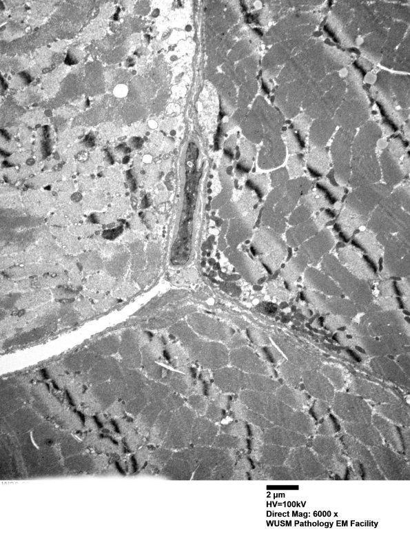 36B1A (Case 36) Deltoid_008 - Copy