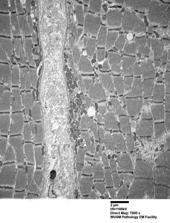 36B2A (Case 36) Deltoid_014 - Copy