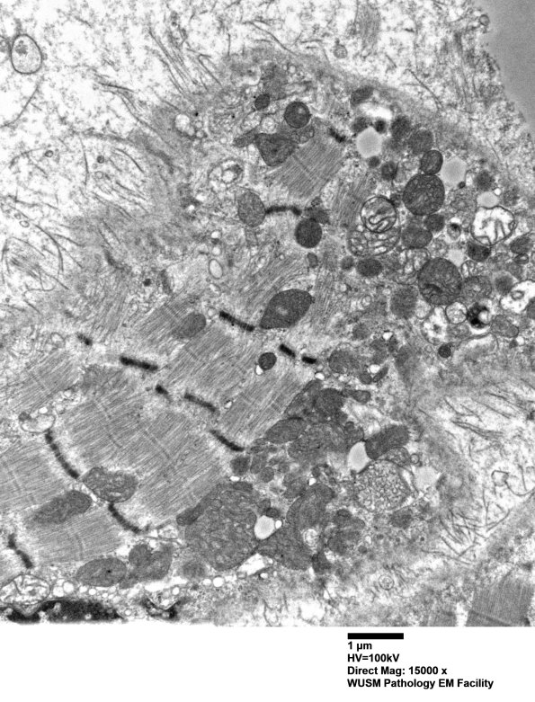 36B3 (Case 36) Deltoid_016 - CopyA